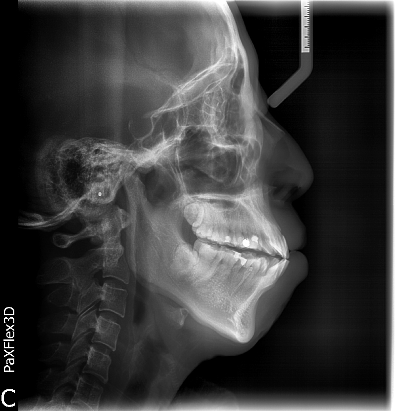 OPG and Cephalogram - Eastwood x- ray